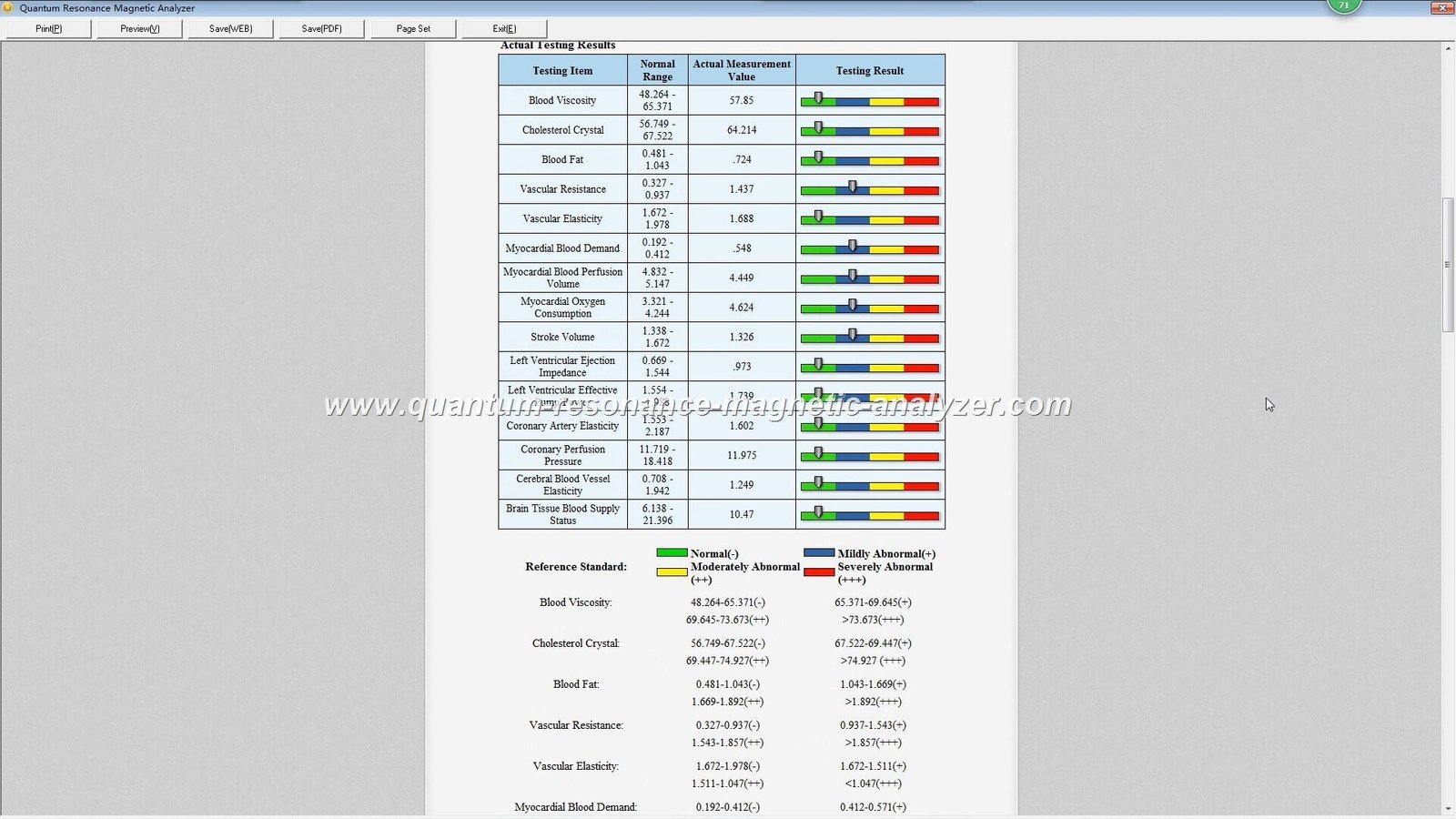 Guía Completa del Analizador Cuántico de Resonancia Magnética en México 6 software analizador cuántico versión clásica interfaz tradicional clara