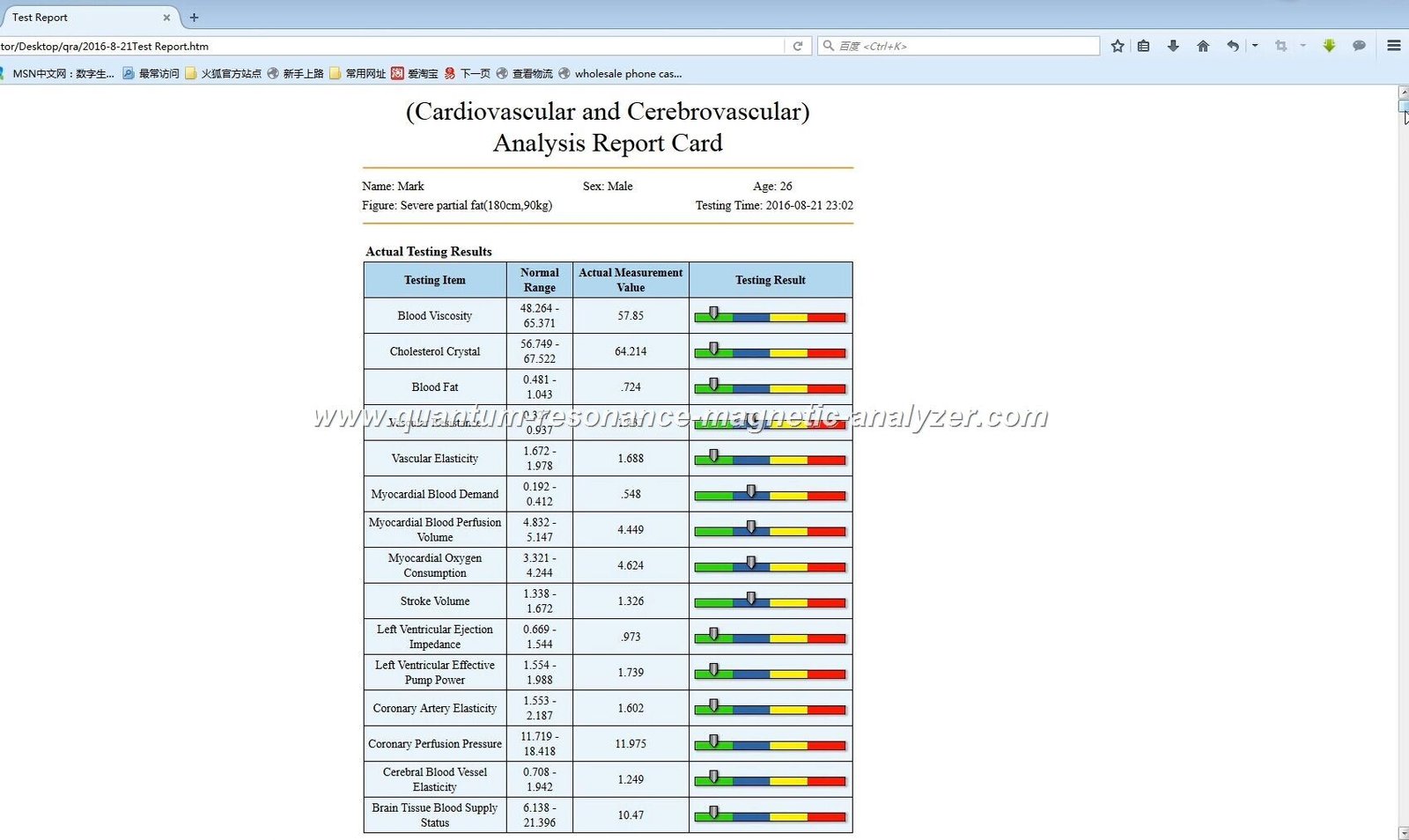 Venta de Analizador Cuántico 9 analizador cuantico bioelectrico de resonancia magnetica método no invasivo paciente cómodo
