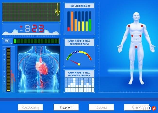 ¿Cómo Usar un Analizador Cuántico Paso a Paso? 8 Pantalla de software del analizador cuántico mostrando múltiples reportes de salud