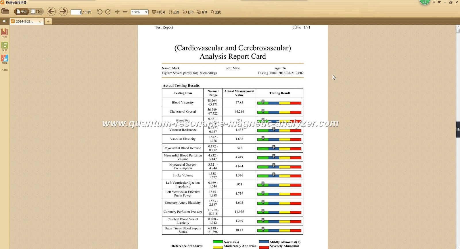 Analizador Cuántico Biomagnético Precio 12 Ejemplo de reporte detallado del analizador cuántico mostrando análisis nutricional